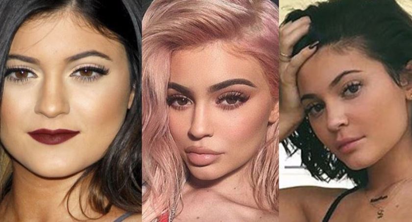 Did Kylie Jenner Really “Get Rid” Of Her Filler?