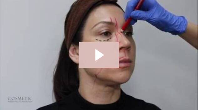 Major Arteries Of The Face – With Dr Ben Chan