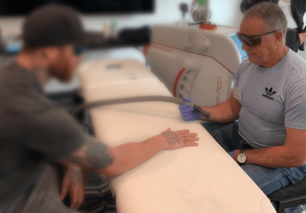 Aussie Medi Tech Laser Tattoo Removal Workshop