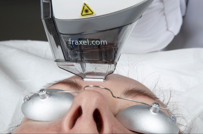 Here’s How Fraxel Laser Technology Can Safely Treat All Skin Types With Maximal Results
