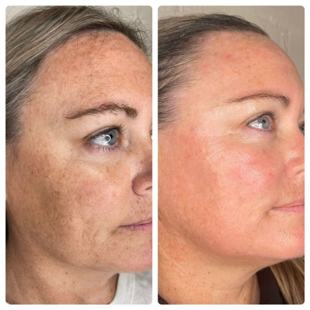 Transform Your Clients’ Skin In 5 Days